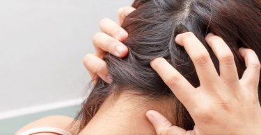 Mal au cuir chevelu
