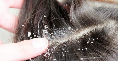 Gommage cuir chevelu